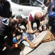 Injured journalists from TRT Arabic channeI are brought to Avde hospital for medical treatment after an Israeli attack at the Nuseirat Refugee Camp in Deir Al Balah, Gaza on April 12, 2024