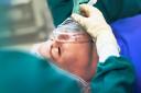 Anaesthetists can fit ventilators for patients struggling to breathe