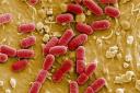 E.coli is a type of bacteria that can cause severe stomach pain and other symptoms.
