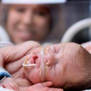 Eligible parents will be able to take up to 12 weeks of paid neonatal care leave