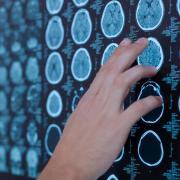 The Scottish Government has previously said Scotland will be a leader in developing AI within healthcare