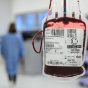 NHS Scotland's blood transfusion service is calling out for donations as stocks of O- and B- blood falls low