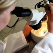 Scientists with Scottish universities have identified a new treatment to detect signs of MND
