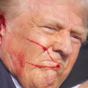 Donald Trump said he was hit in the ear by a bullet at a campaign rally