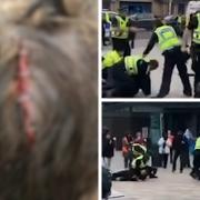 A head wound suffered by a protester amid alleged police violence during clashes at Govan Cross on July 3