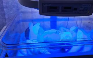 Humza Yousaf shared an image of new-born baby Liyana undergoing phototherapy